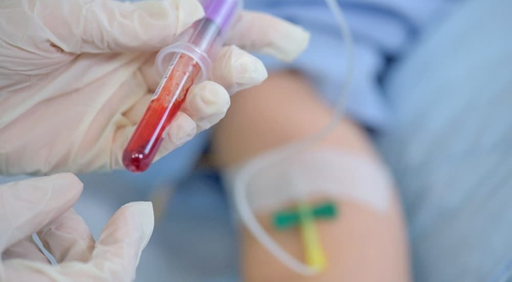 Fasting for Blood Work: Which Tests Require It, How Long, and What You Can Drink