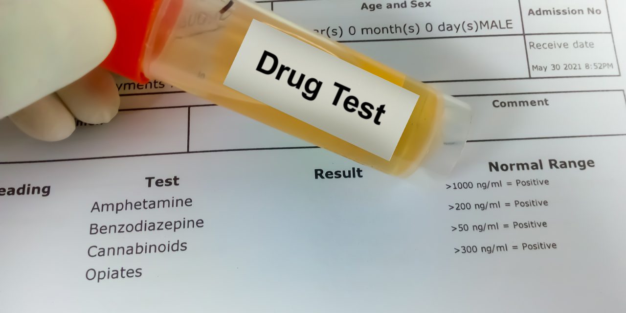 Delta 8 drug test