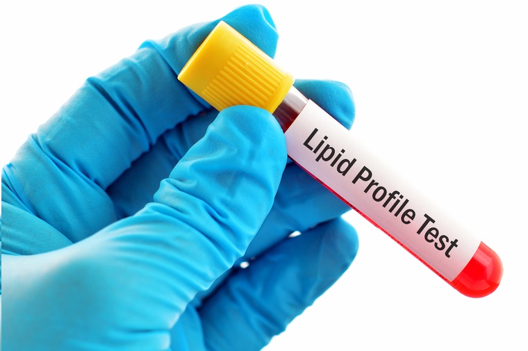 lipid panel test