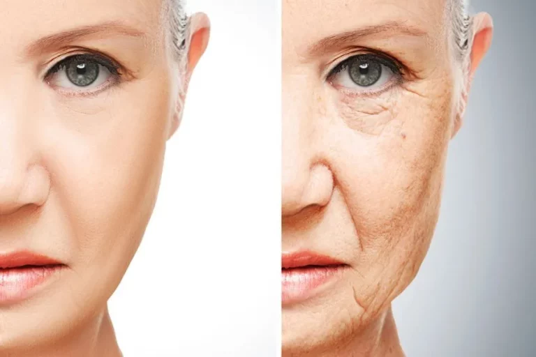 Read more about the article The Truth About Ozempic Face: What You Need to Know